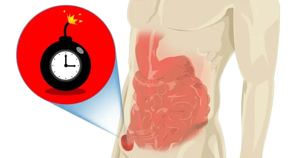 كيف تتغلب على الفتق الإربي وتستعيد نشاطك وحيويتك